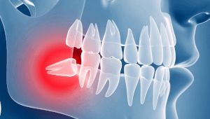Причини зубного болю та як знизити його інтенсивність